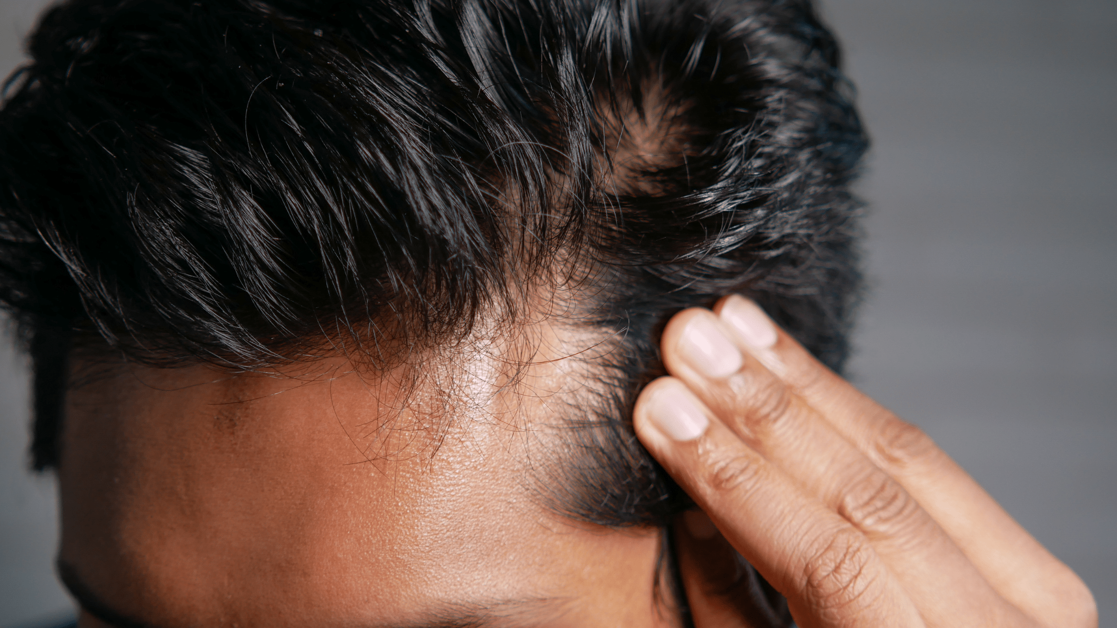 Improving Men's Health Albany Clinics Addressing Hair Loss Concerns